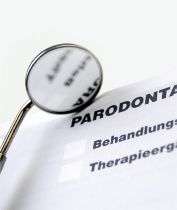 parodontosebehandlung